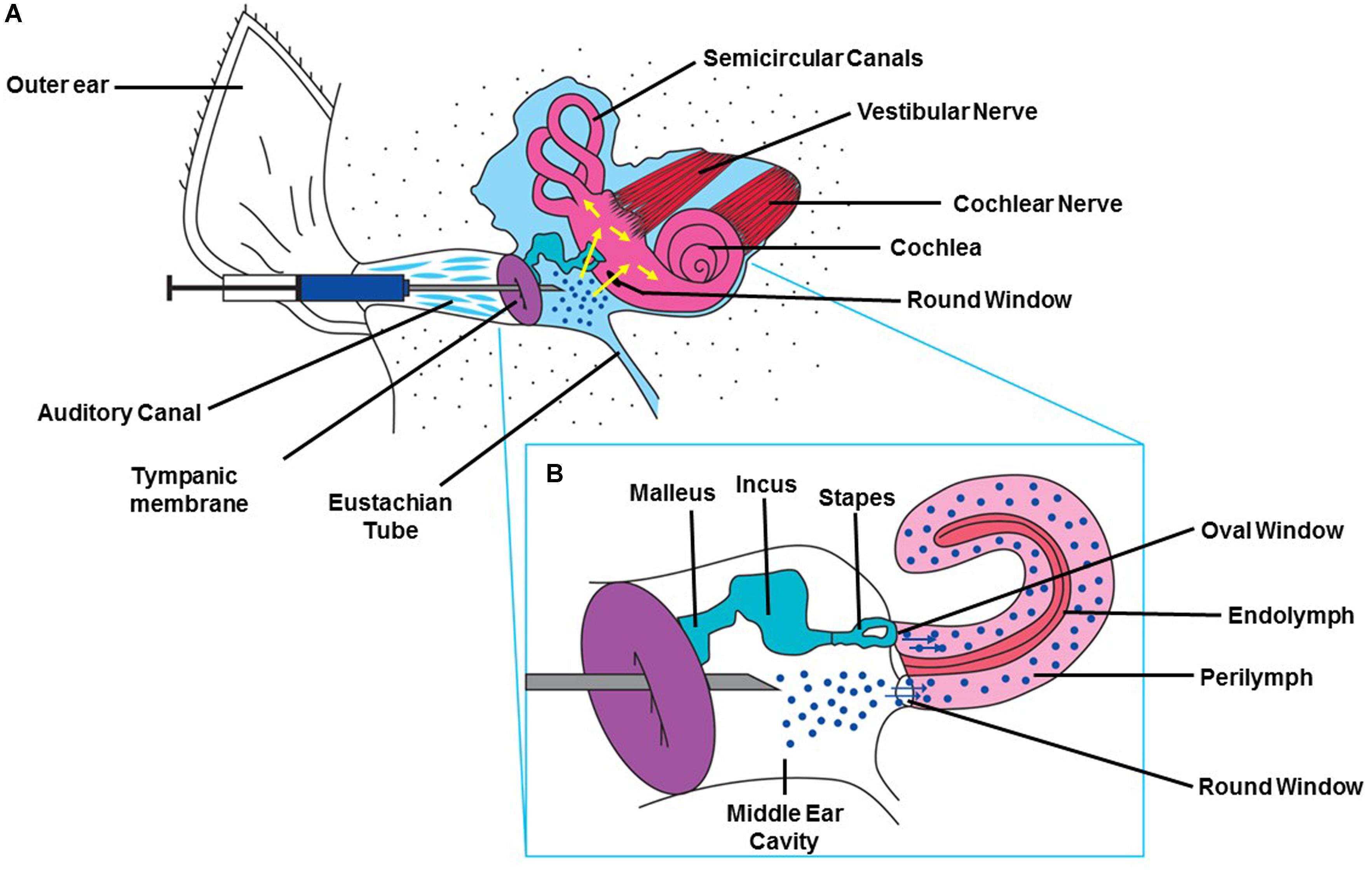 Tympanic Membrane Injection