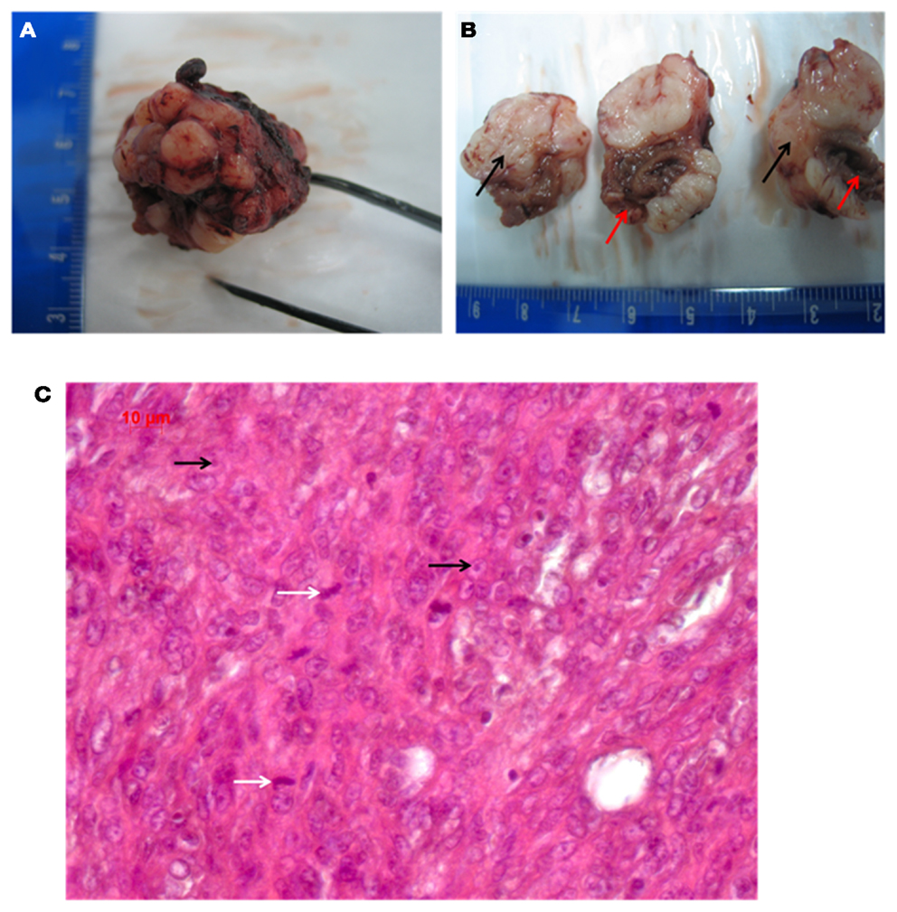 Frontiers | Inverse Relationship between Tumor Proliferation 