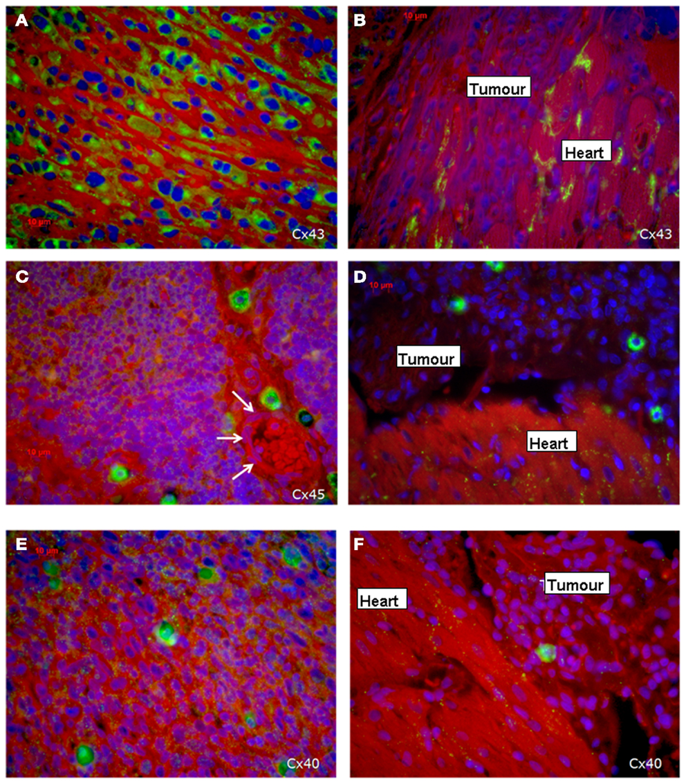Frontiers | Inverse Relationship between Tumor Proliferation 
