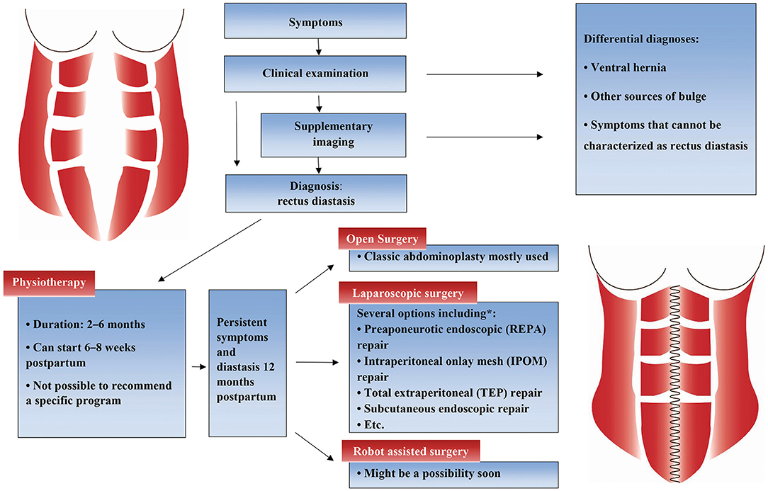 Frontiers  Treatment Options for Abdominal Rectus Diastasis