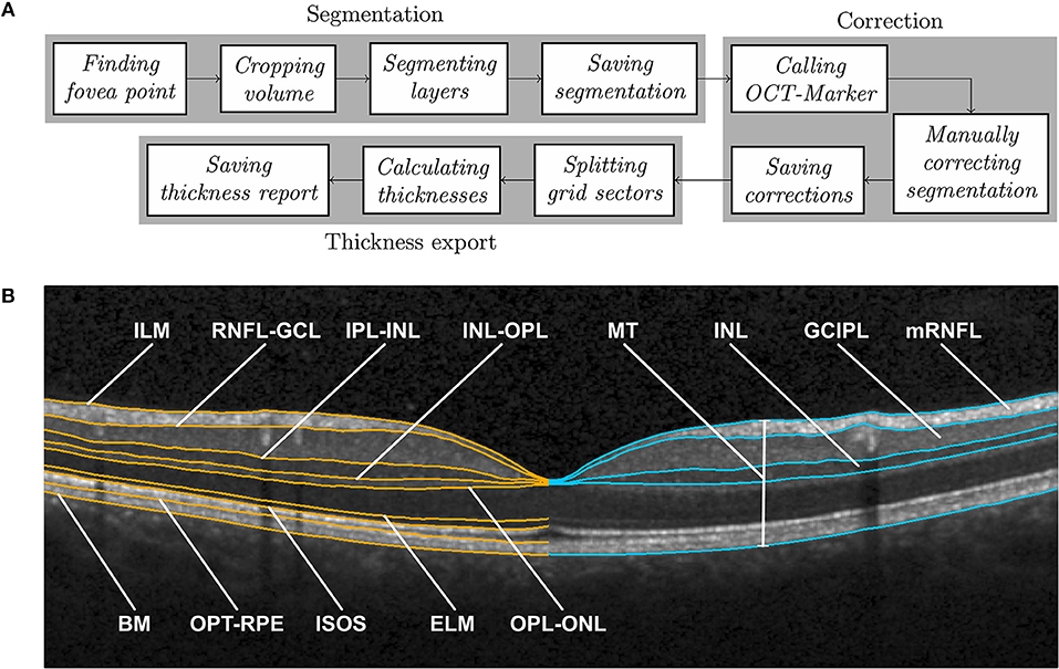 retinal layers oct