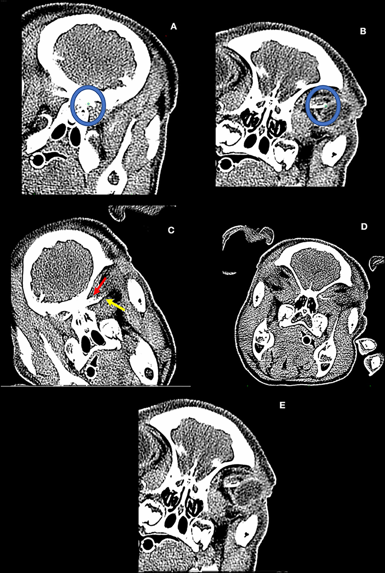 osirix md stanford