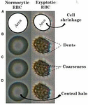 Frontiers | Computerized Morphometric Analysis of Eryptosis | Physiology