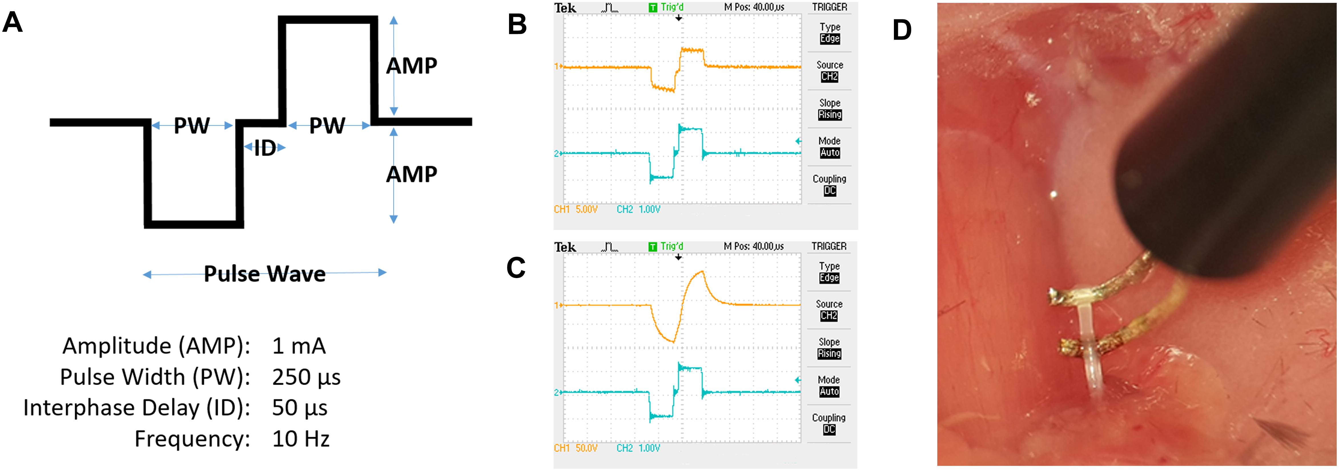 (A) Schematic representation of a pulse wave. 