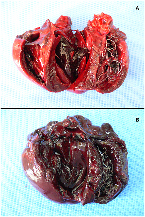 heart wormer for humans