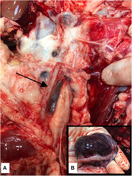 Frontiers  Fatal Ovarian Hemorrhage Associated With Anticoagulation  Therapy in a Yucatan Mini-Pig Following Venous Stent Implantation