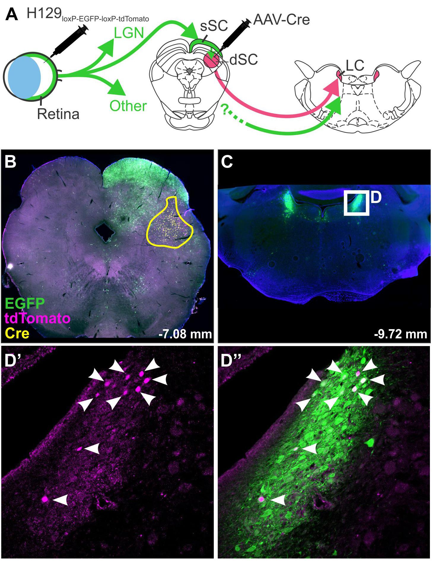 Frontiers A Student’s Guide to Neural Circuit Tracing Neuroscience