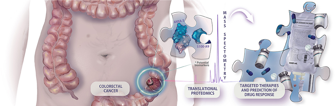 colorectal cancer updates