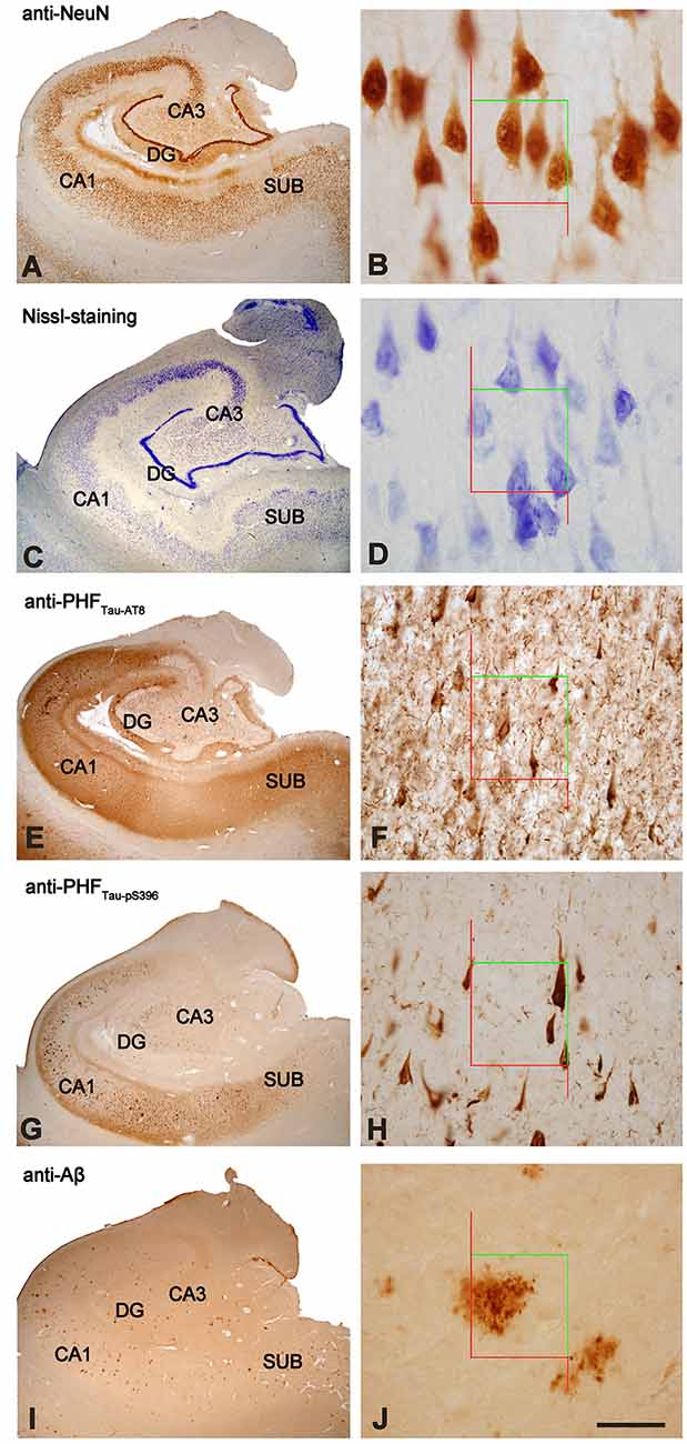 plaque-filled brains