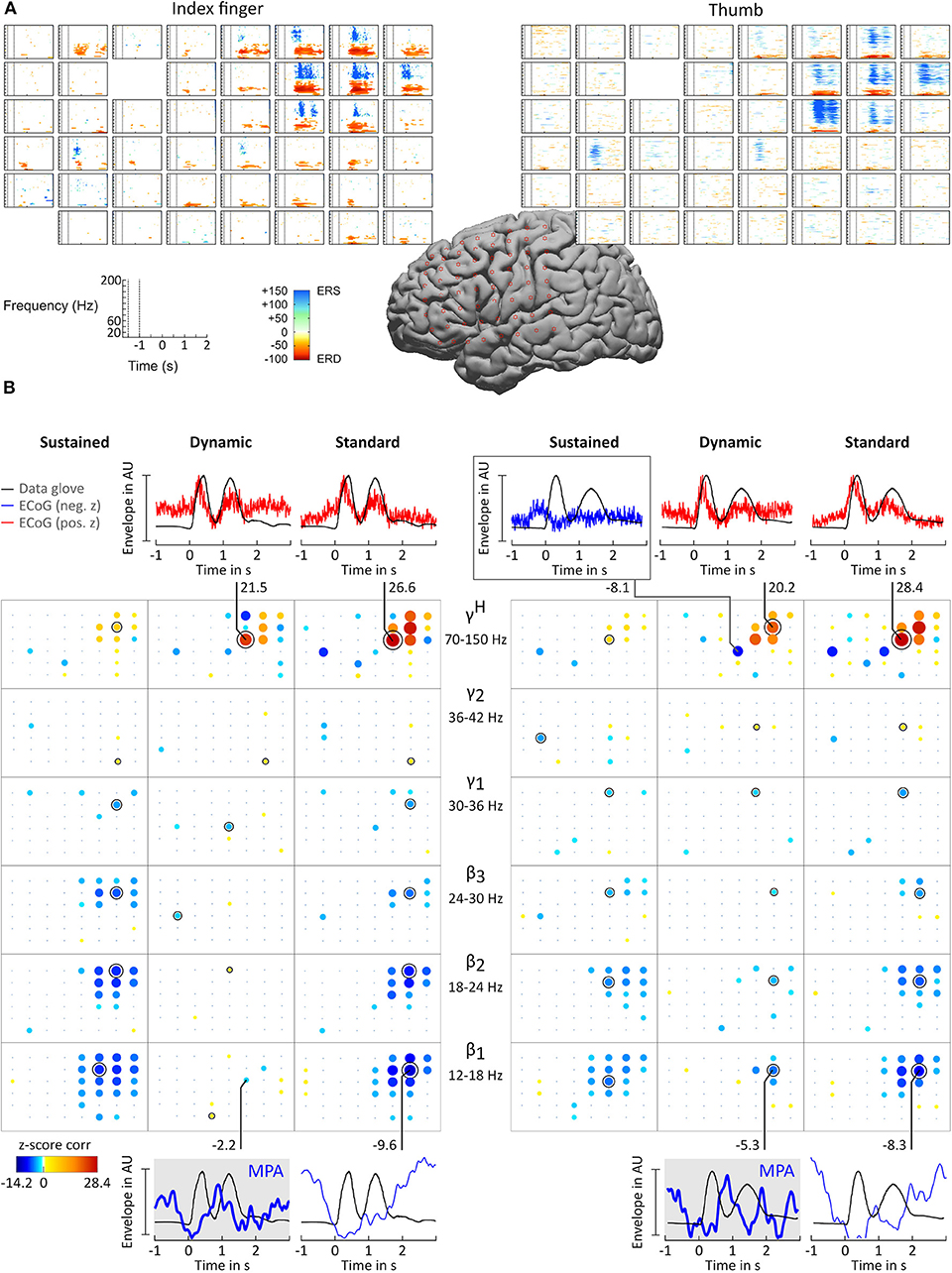 Frontiers Ecog Beta Suppression And Modulation During Finger Extension And Flexion Neuroscience