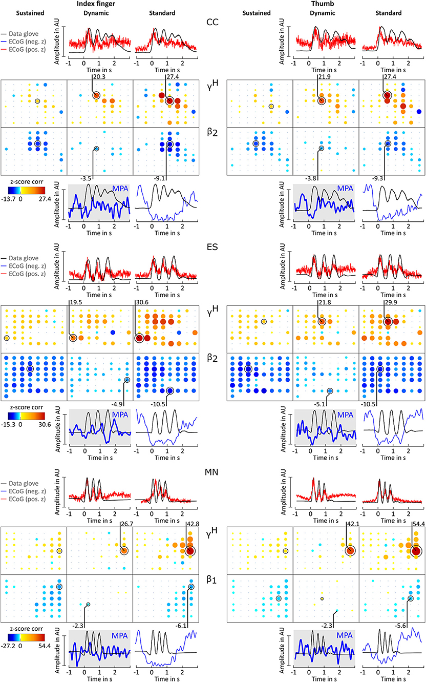Frontiers Ecog Beta Suppression And Modulation During Finger Extension And Flexion Neuroscience