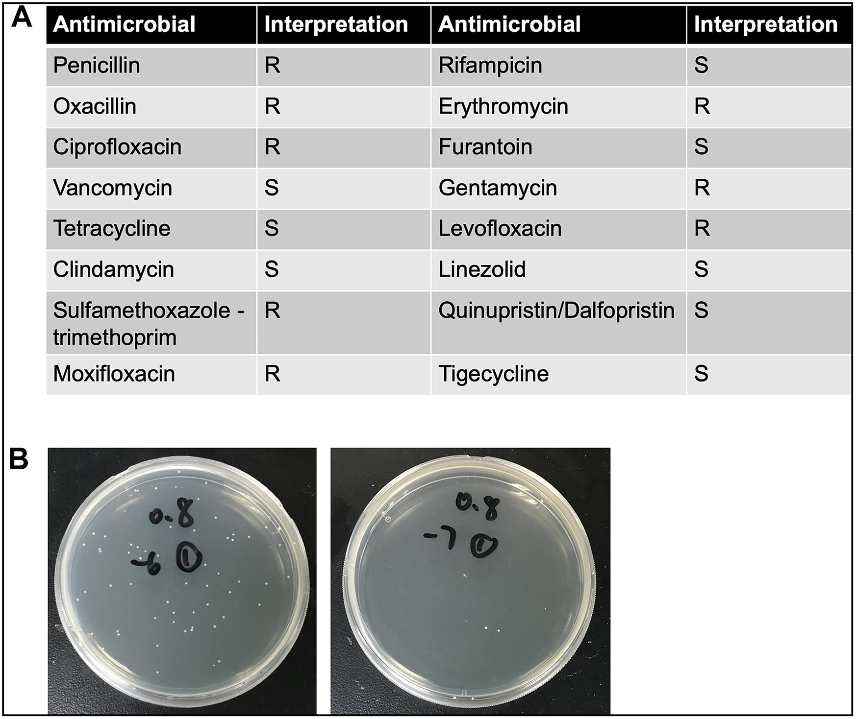 staphylococcus epidermidis endospore stain