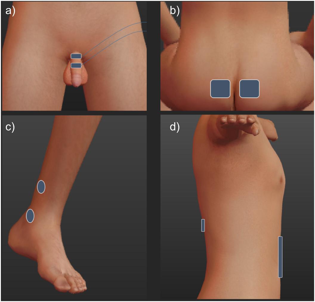 TENS (transcutaneous electrical nerve stimulation) - NHS