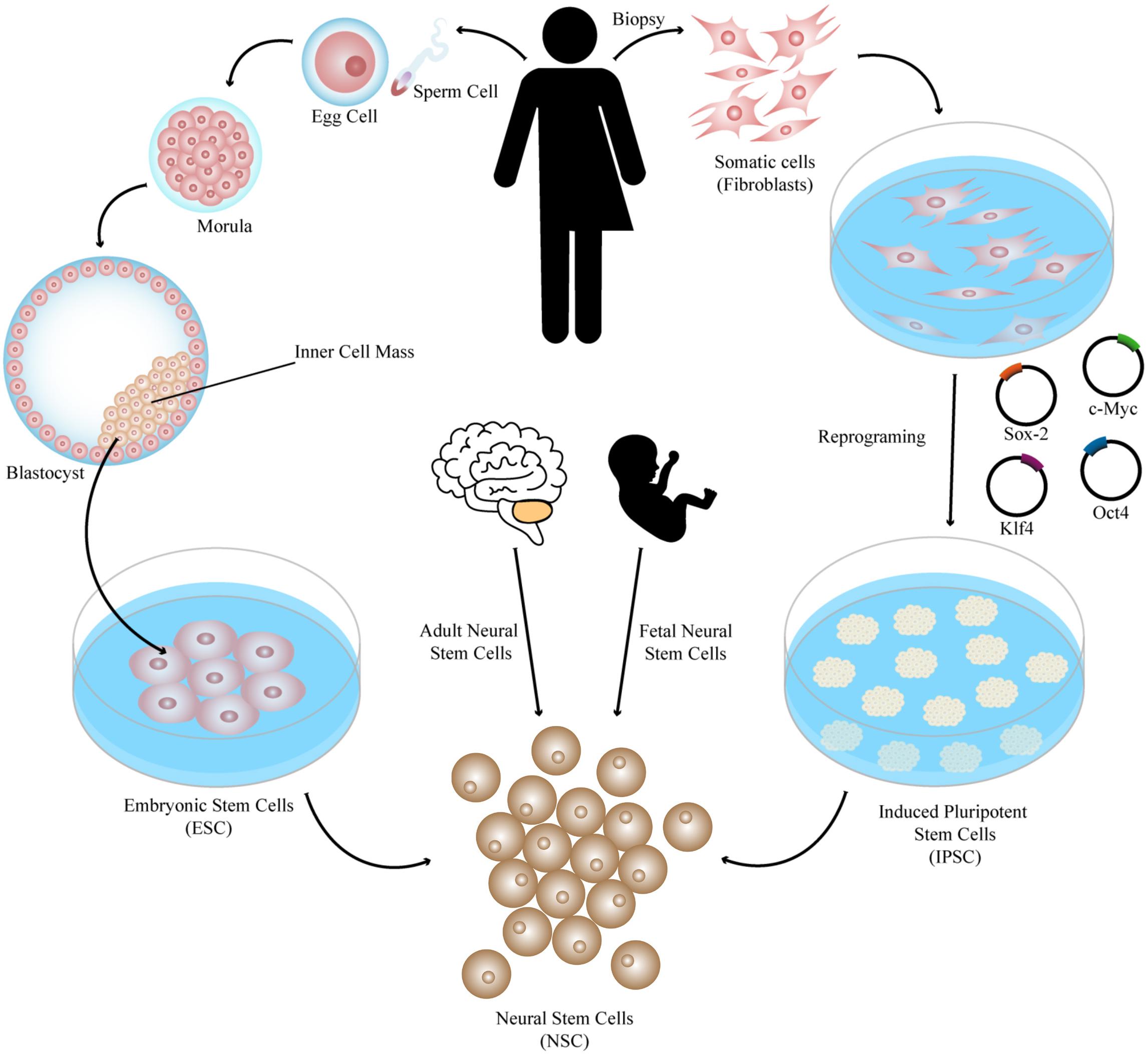 Frontiers | Successes and Hurdles in Stem Cells Application and Production  for Brain Transplantation