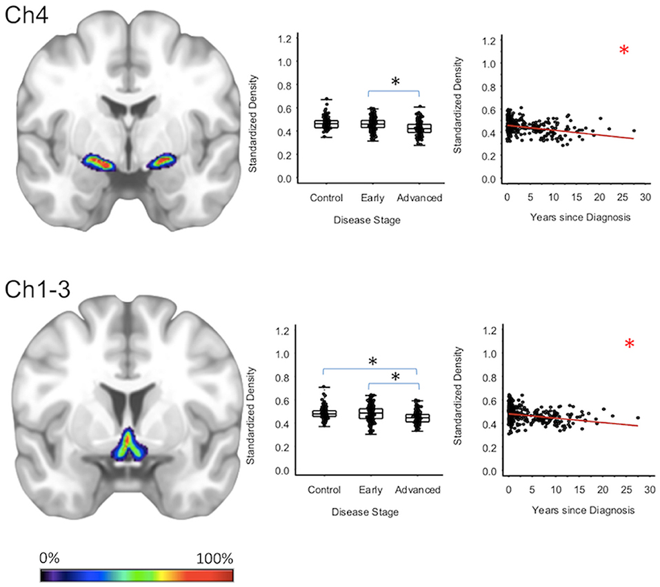 Frontiers Brain Mri Reveals Ascending Atrophy In Parkinson S Disease Across Severity Neurology