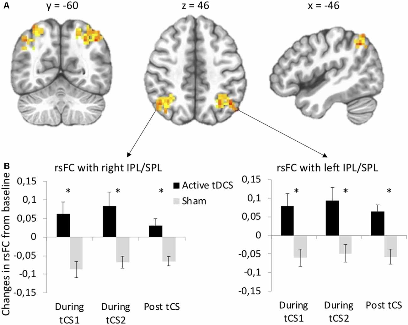 Frontiers  Differential tDCS and tACS Effects on Working Memory-Related  Neural Activity and Resting-State Connectivity