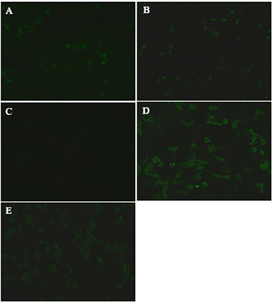 anti mog demyelinating disease anti mog demyelinating disease