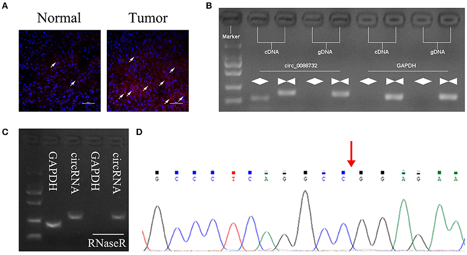 Frontiers | Lcn2-derived Circular RNA (hsa_circ_0088732