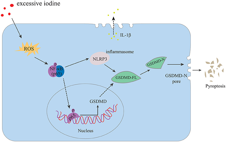 Excess iodine in body top