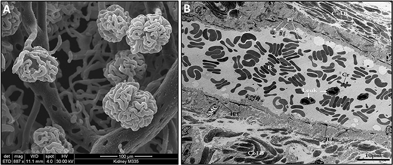 Figure 2 - (A) Scanning electron microscope image showing a structure called the glomeruli in the kidney.