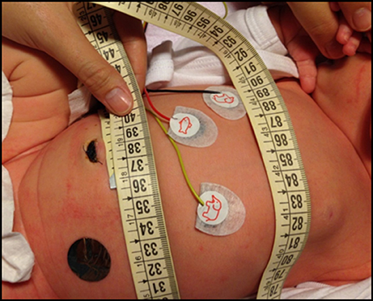 Measurement of the circumference of a 14 months old baby's head