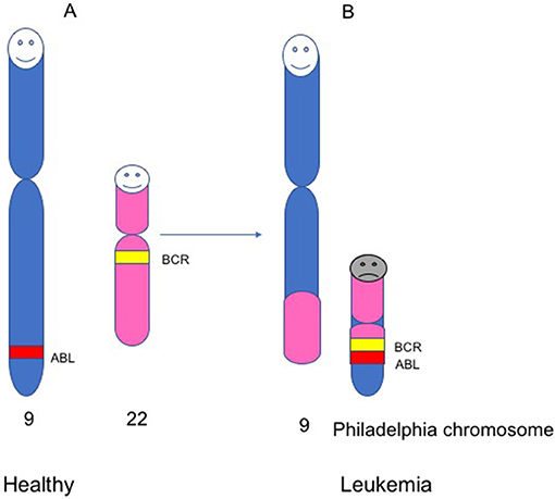 Figure 3 - The Philadelphia chromosome. Healthy people carry 23 pairs of chromosomes (46 chromosomes total).