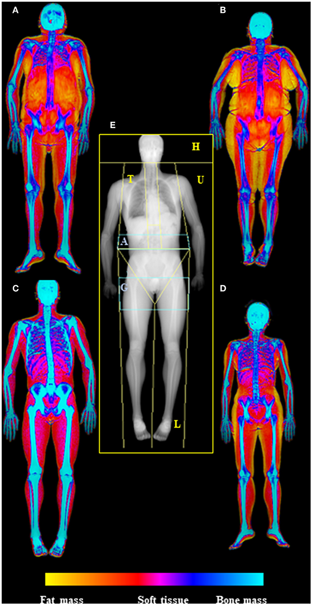 Baseline Body Fat Scale