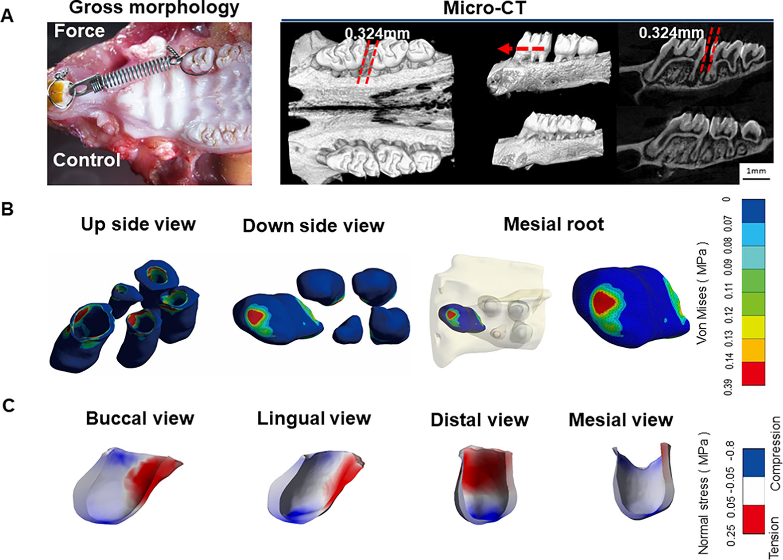 The influence of age and orthodontic debonding on the prevalence and  severity of enamel craze lines - ScienceDirect