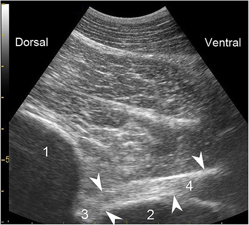 Frontiers | Ultrasonography-Guided Perineural Injection of the Ramus ...