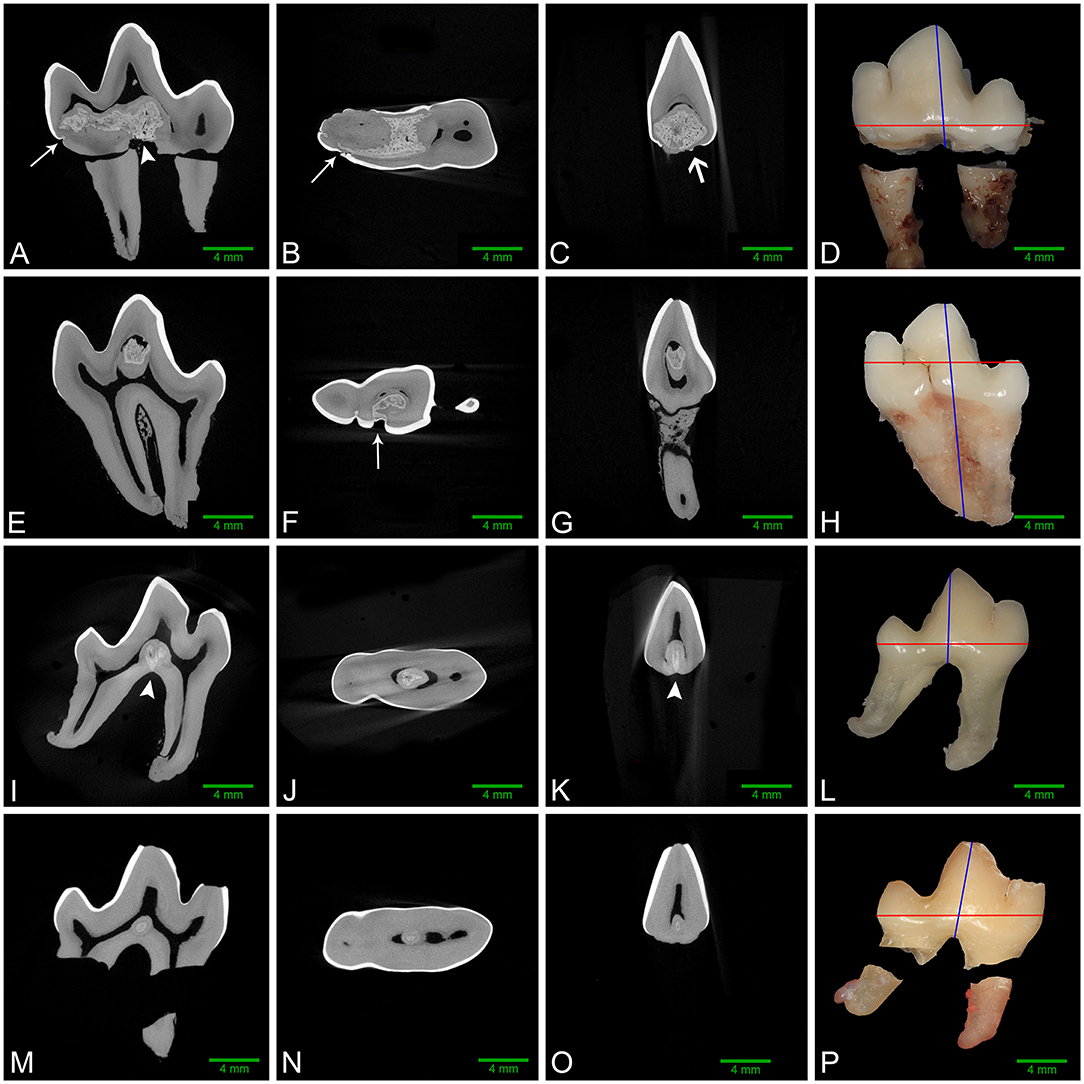 Frontiers | Mandibular Carnassial Tooth Malformations in 6 Dogs—Micro-Computed Tomography and Histology Findings Frontiers | Mandibular Carnassial Tooth Malformations in 6 Dogs—Micro-Computed Tomography and Histology Findings