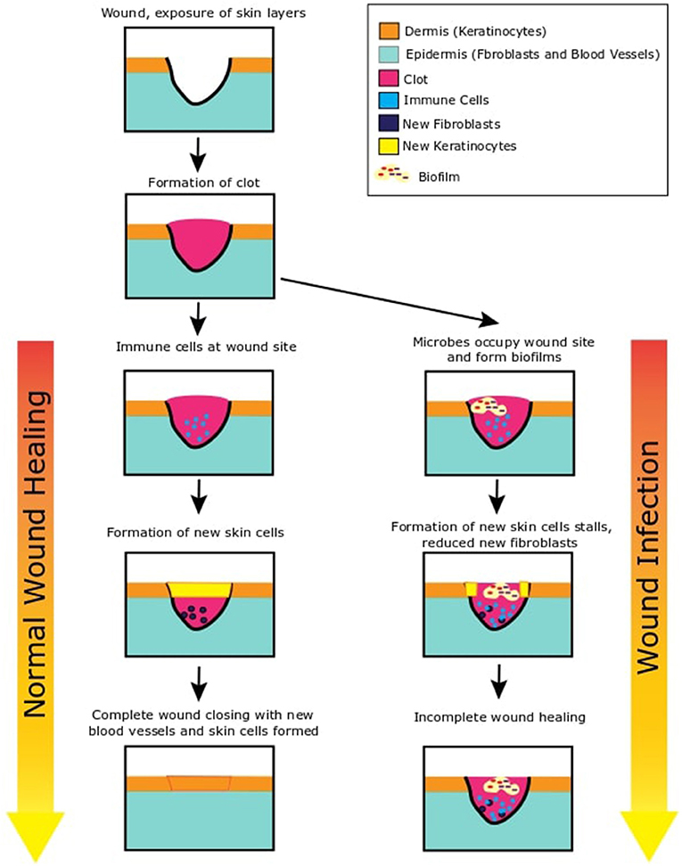 How to tell if a wound is healing or infected