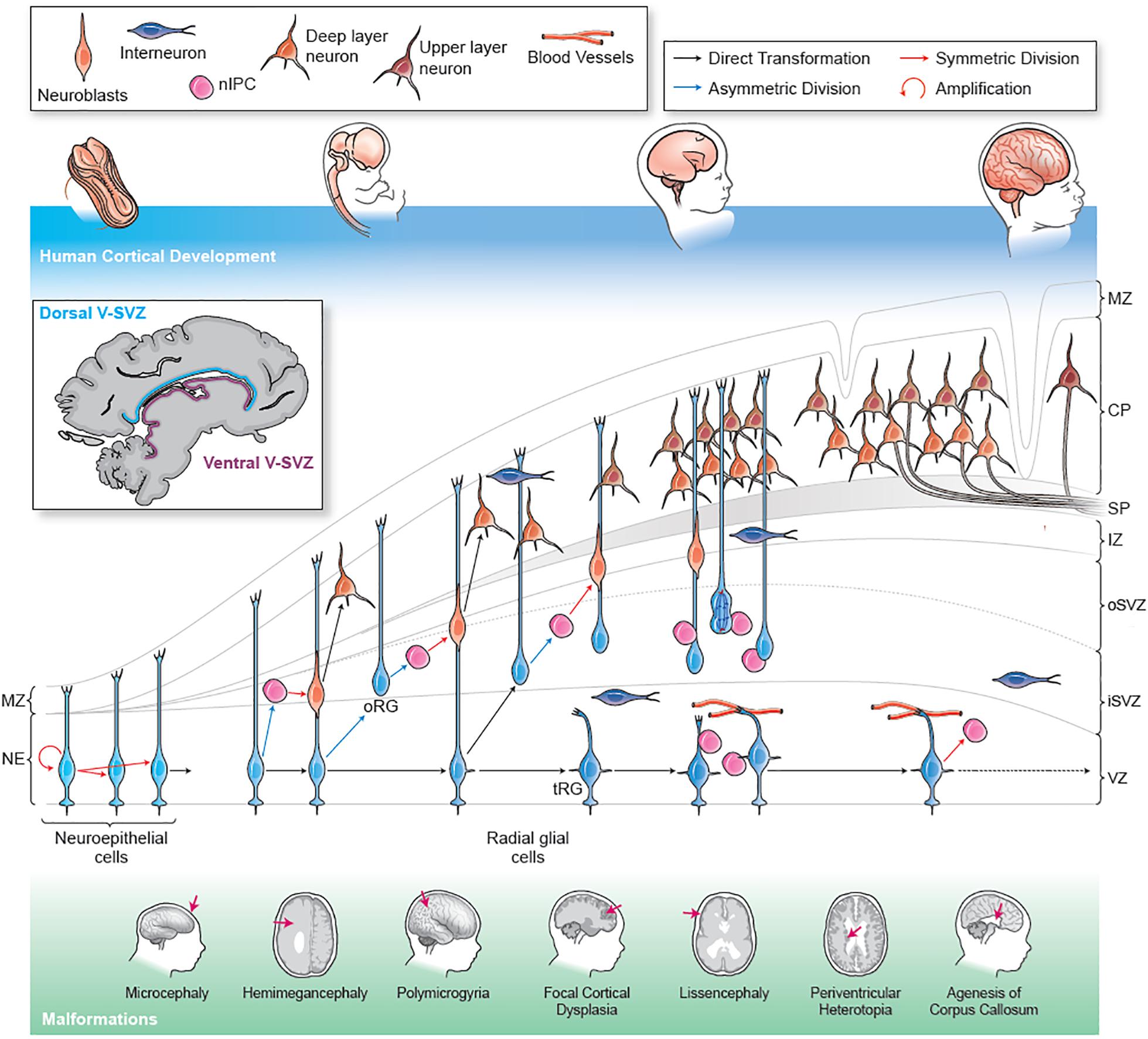 Frontiers | Cortical Malformations: Lessons in Human Brain Development ...