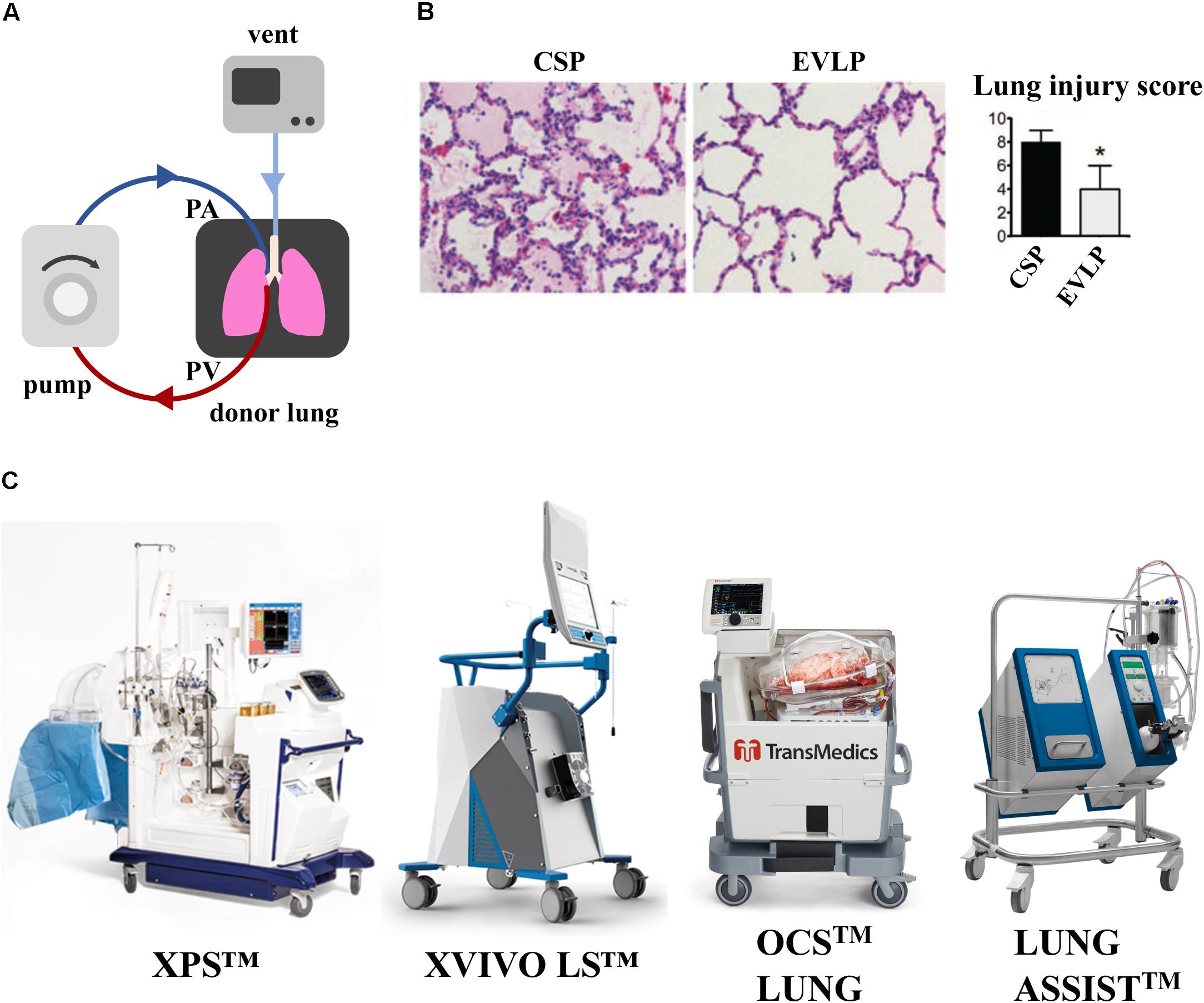 Frontiers Bioengineering Of Pulmonary Epithelium With