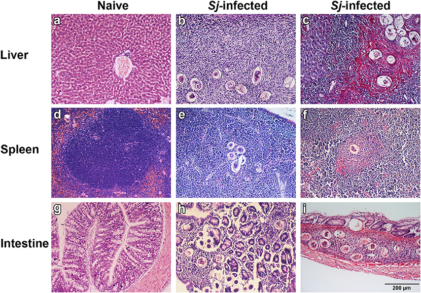 schistosomiasis liver histology