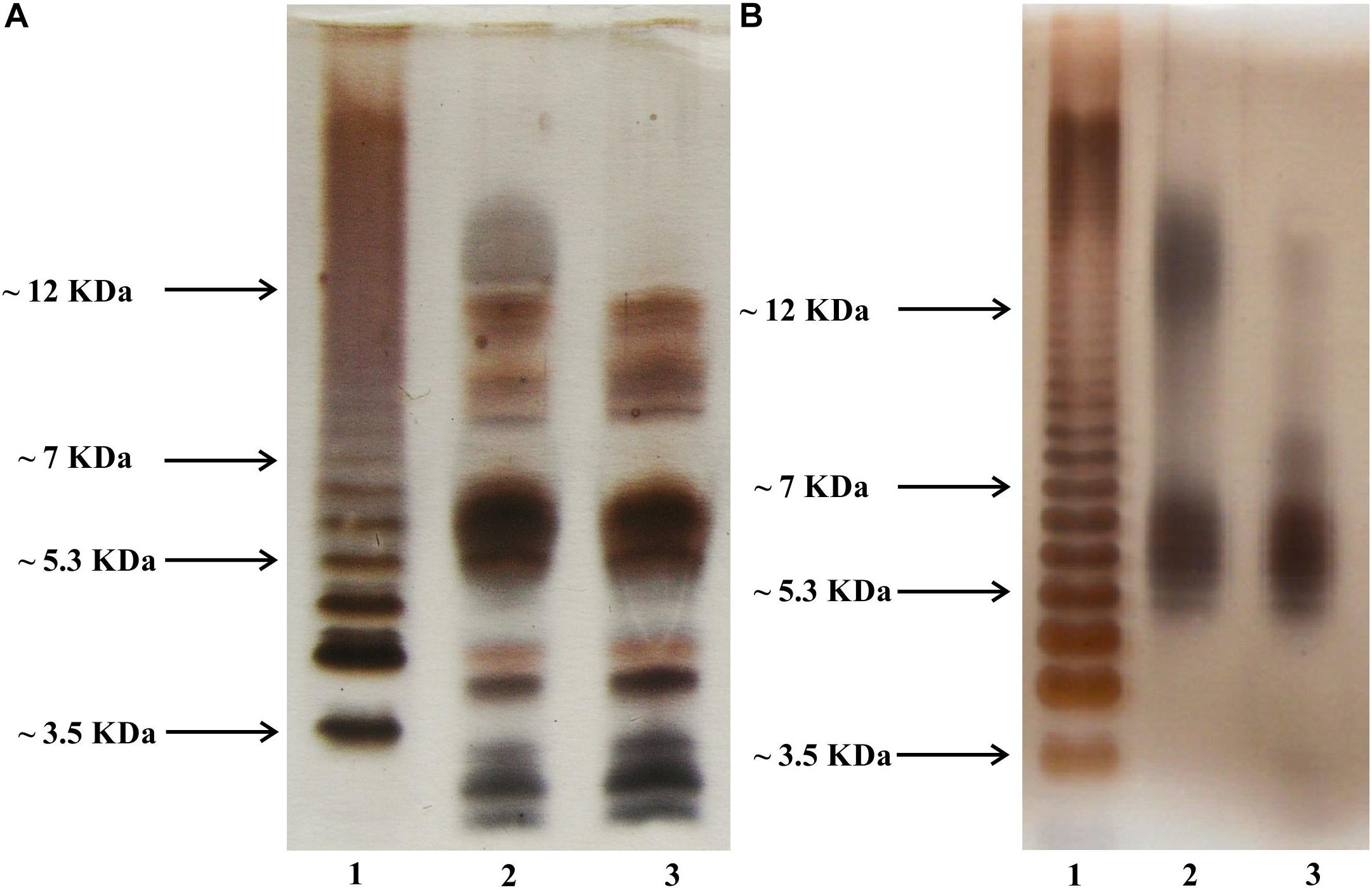 Role of Legionella pneumophila Serogroup 1 Lipopolysaccharide in Host-Pathogen Interaction