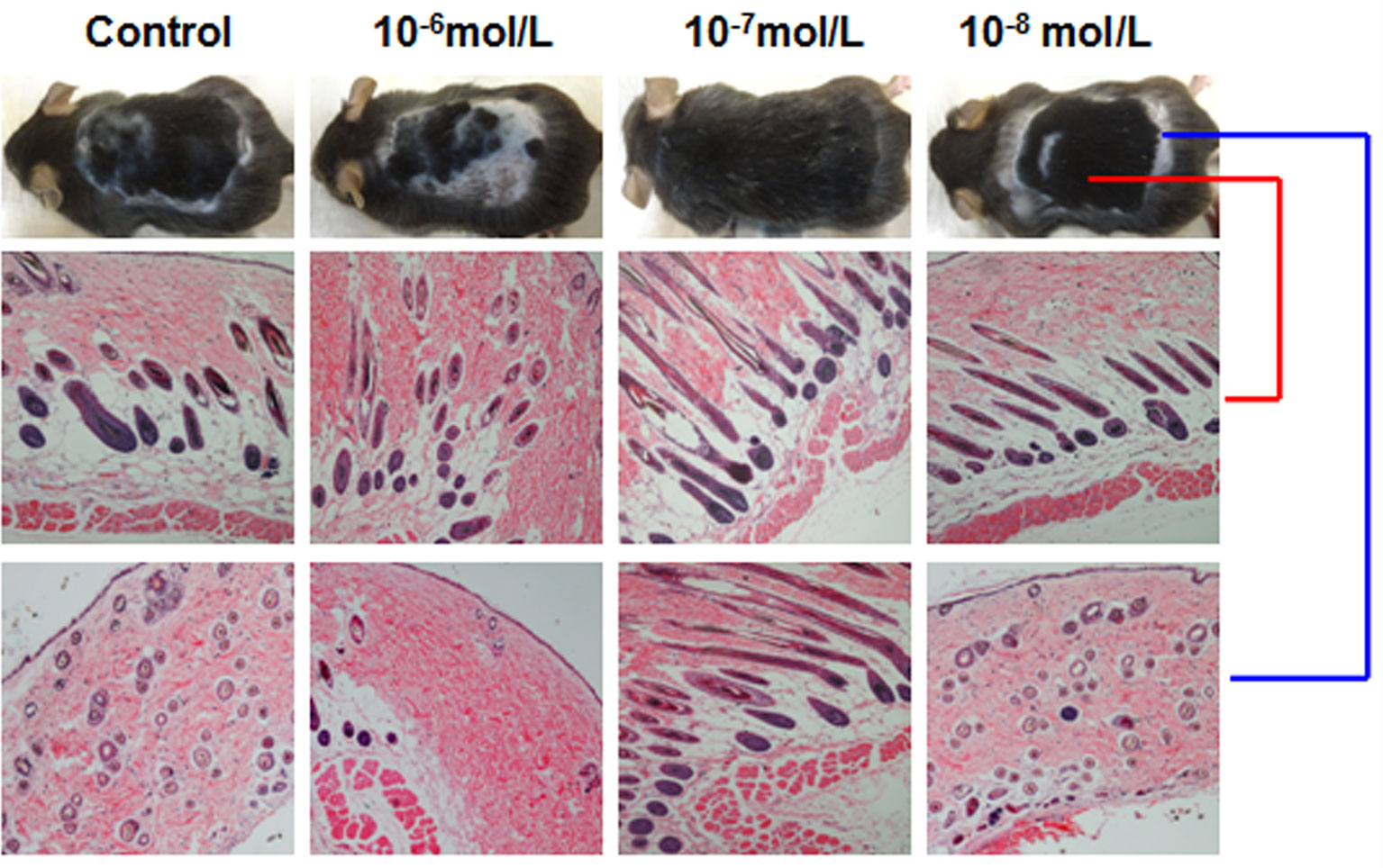 Frontiers | Dihydrotestosterone Regulates Hair Growth Through the Wnt/β-Catenin Pathway in C57BL/6 Mice and In Vitro Organ Culture Frontiers | Dihydrotestosterone Regulates Hair Growth Through the Wnt/β-Catenin Pathway in C57BL/6 Mice and In Vitro Organ Culture