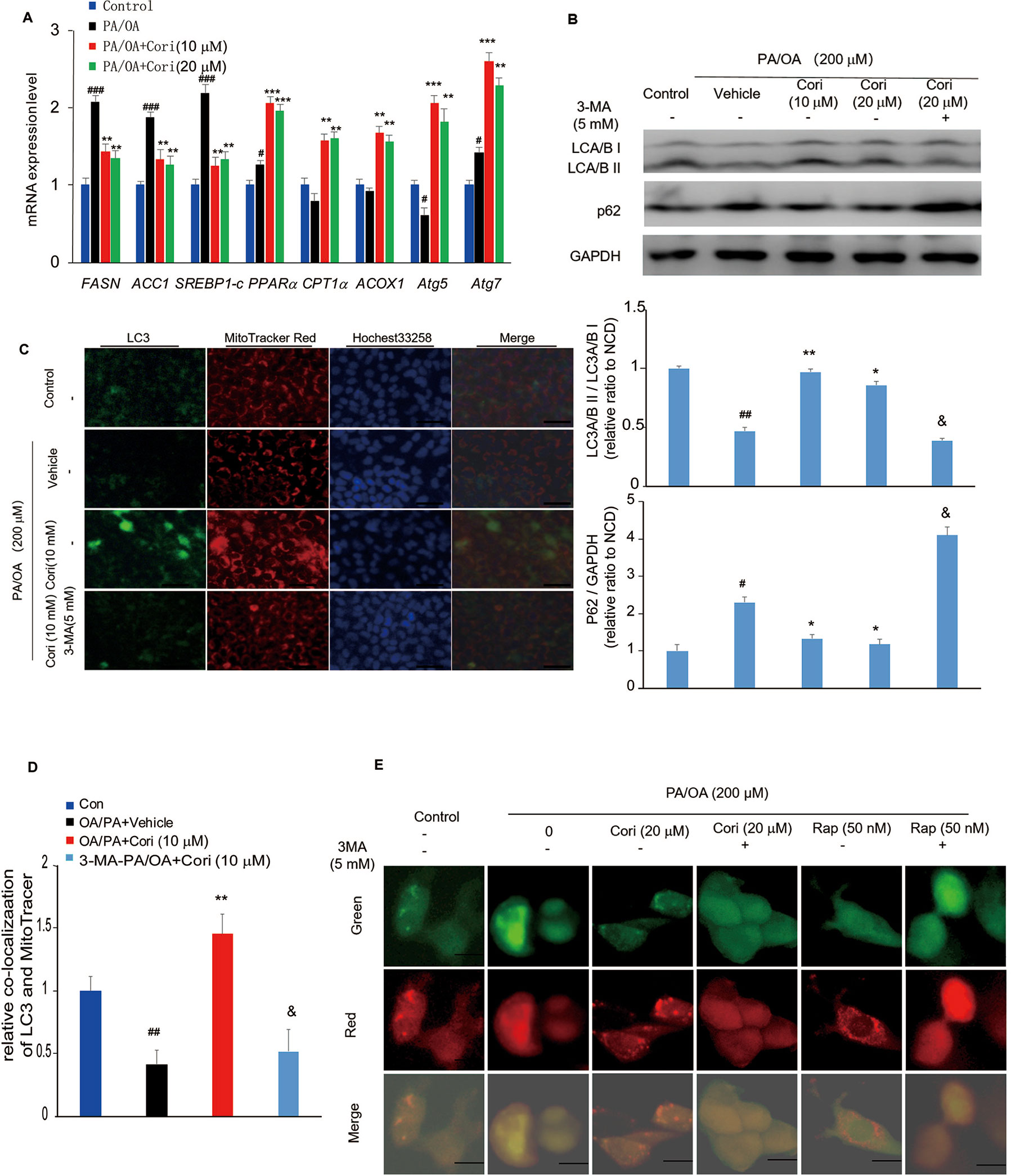 Frontiers | Corilagin Alleviates Nonalcoholic Fatty Liver Disease in ...