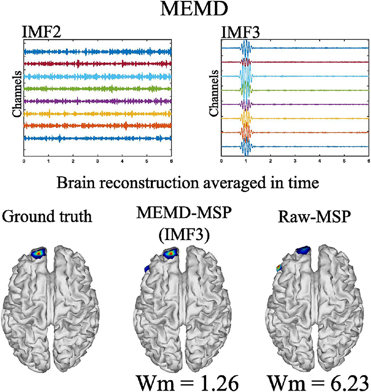 neuroguide symptom network radar map