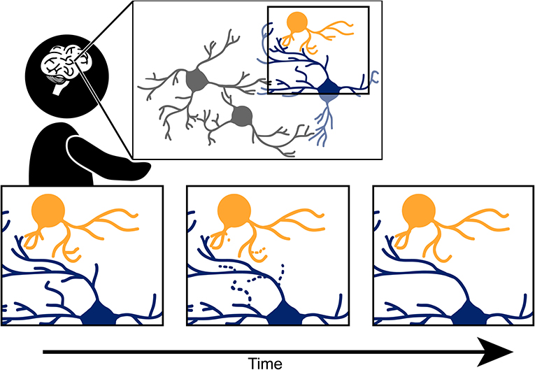 Figure 2 - The pruning process in the brain.
