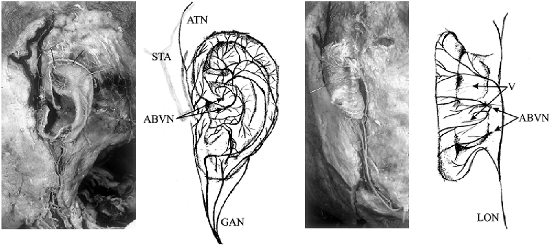 Vagal nerve stimulators? - Questions and Answers ​in MRI