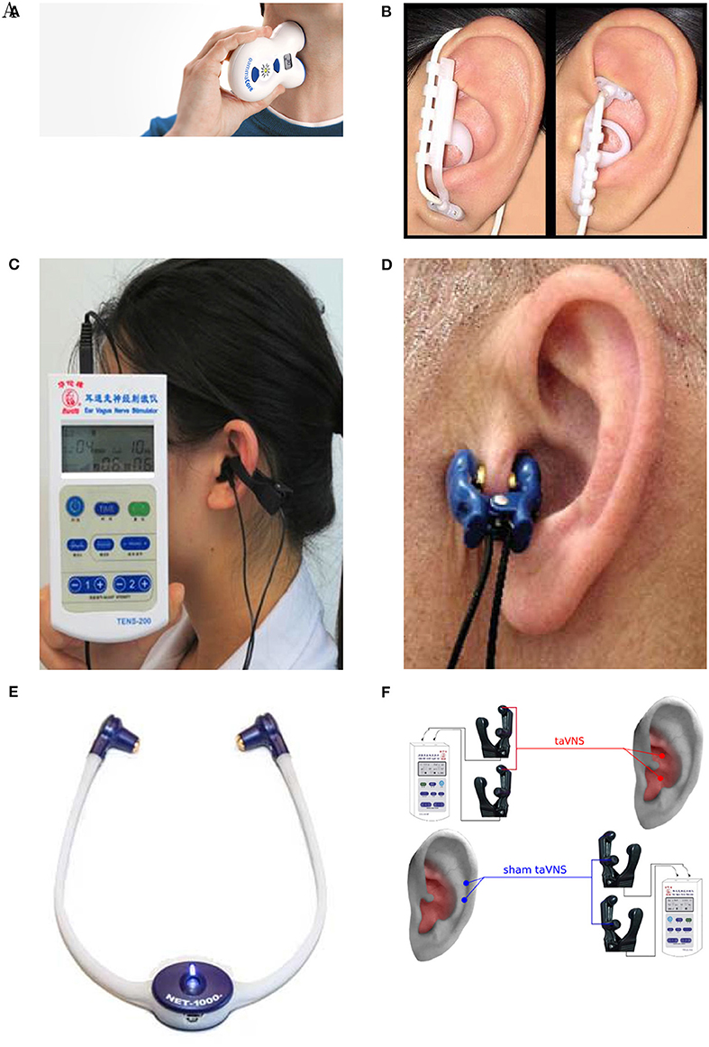 Auricular Vagus Nerve Stimulation Device - Vagustim Health