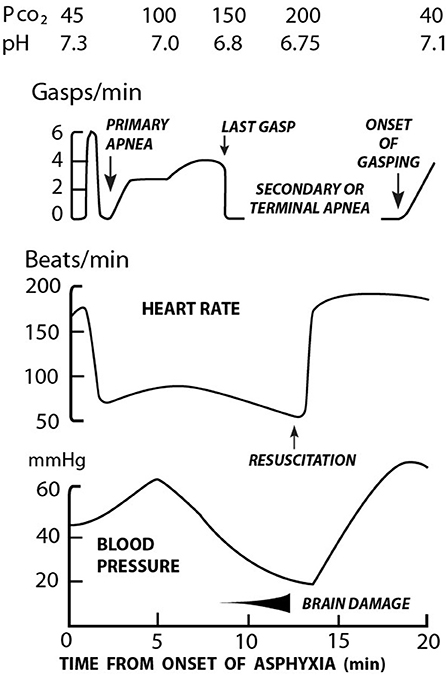 Frontiers A Global View Of Neonatal Asphyxia And Resuscitation