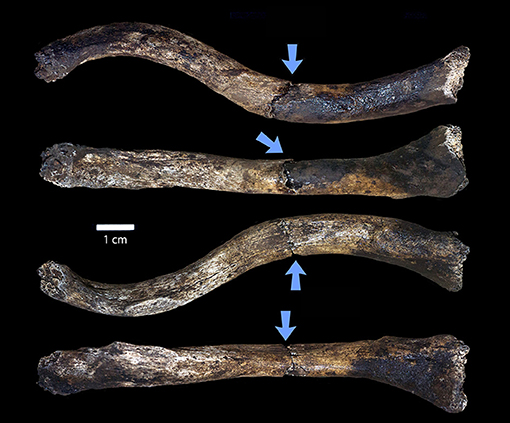 Figure 3 - From top to bottom, Neo’s right collarbone (clavicle) shown from the top, front, bottom, and back.