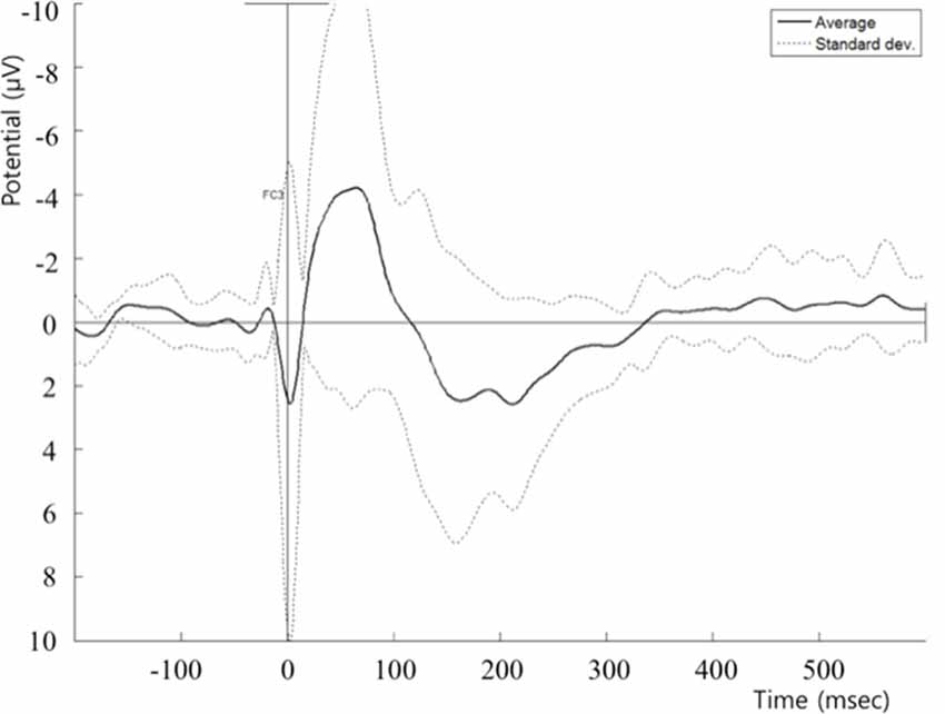 Frontiers Interhemispheric And Intrahemispheric Connectivity From The Left Pars Opercularis Within The Language Network Is Modulated By Transcranial Stimulation In Healthy Subjects Human Neuroscience