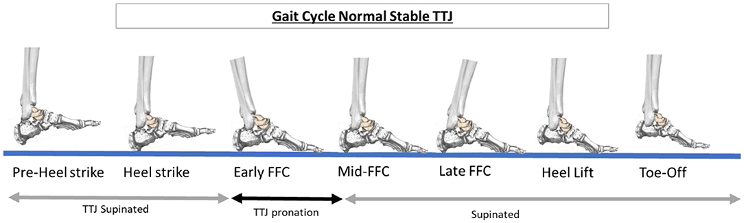 Flexible Vs. Rigid Flatfoot Condition in Kids - The Center Oregon