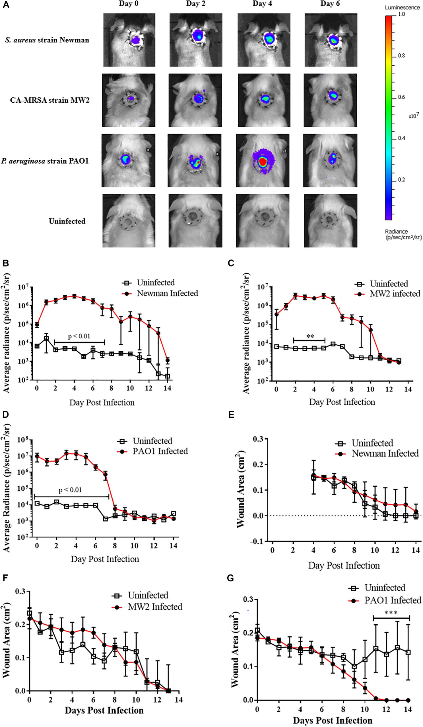 Treatment for S. aureus skin infection works in mouse model