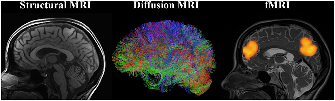neuroplasticity research paper