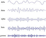 Frontiers | Electroencephalography: Clinical Applications During the ...