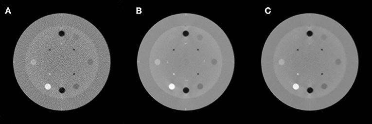 Frontiers | Analytical Low-Dose CBCT Reconstruction Using Non-local ...