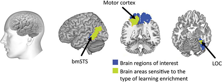 Figure 3 - Brain imaging results.